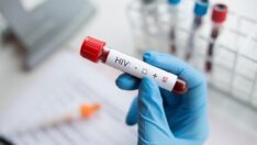Türkiye’de kaç kişinin HIV virüsü taşıdığı açıklandı