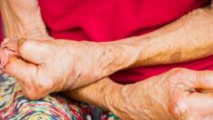 Cüzzam hastalarından ayakkabı talebi