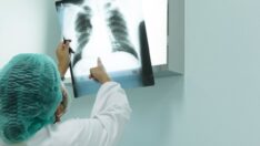 Akciğerde su toplanması (Plörezi) nedir, belirtileri neler?