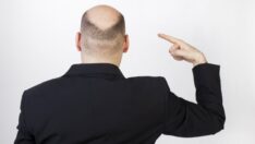 Bilim insanlarından şaşırtan iddia: Kel kalma olasılığını böyle tespit ettiler