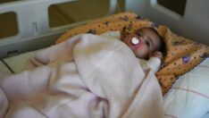 Akciğer atardamarlarında darlık olan bebeğe aynı gün iki ameliyat yapıldı