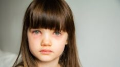 Corona virüsünün Arcturus varyantının yeni belirtisi ortaya çıktı: Buna dikkat edin