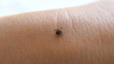 İngiltere’de kenelerden bulaşan ensefalit hastalığı görüldü