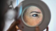 İyileşmeyen yaralar “cilt kanseri” belirtisi olabilir