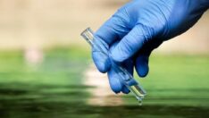 Kolera salgını 5 can aldı