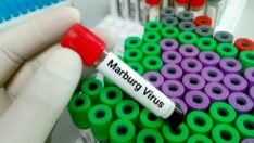 Marburg virüsü yayılmaya devam ediyor
