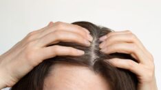 Saçlardaki beyazlaşmayı tersine çevirmek veya önlemek mümkün mü? Umut veren araştırma