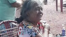 Doktorlar şaştı: 81 yaşında hamile kadın 56 yıl “taş bebek”le yaşamış