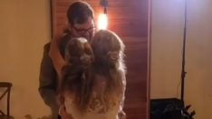 Yapışık ikiz kardeşlerden biri sevgilisiyle evlendi