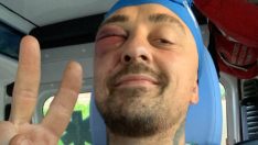 İtalyan şef Rubini darbedildi