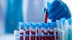 ‘Türkiye’de 1,5 milyona yakın talasemi taşıyıcısı var’