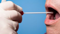 Prostat kanserini erken teşhis için tükürük testi geliştirildi