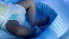 Bebeklerin mavileşmesine yol açan hastalık: Mavi bebek sendromu…