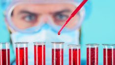 Şaşırtan sonuç! Düşük zeka düzeyine sahip olan kan grubu açıklandı