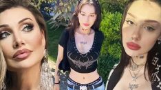 Umut Akyürek tedavi gören kızının son halini paylaştı