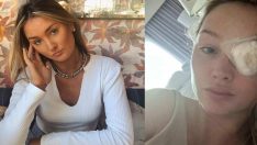 2 yılda 9 kez ameliyat olmuştu: Ünlü model çanta kayışının gözüne çarpmasıyla kör oldu