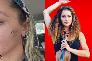 EŞİM TARAFINDAN DARP EDİLDİM