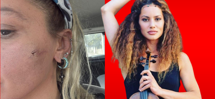 EŞİM TARAFINDAN DARP EDİLDİM