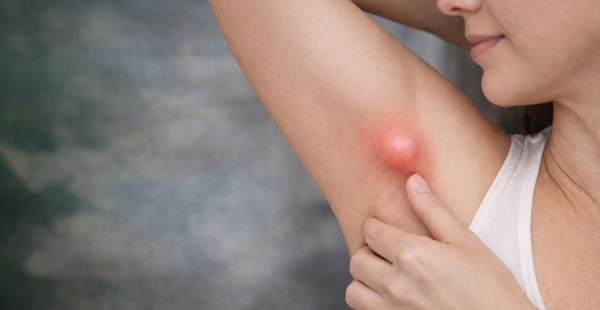 KOLTUK ALTINDAKİ ŞİŞLİK HER ZAMAN MASUM DEĞİL: EKTOPİK MEME DOKUSU UYARISI