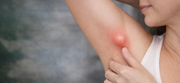 KOLTUK ALTINDAKİ ŞİŞLİK HER ZAMAN MASUM DEĞİL: EKTOPİK MEME DOKUSU UYARISI