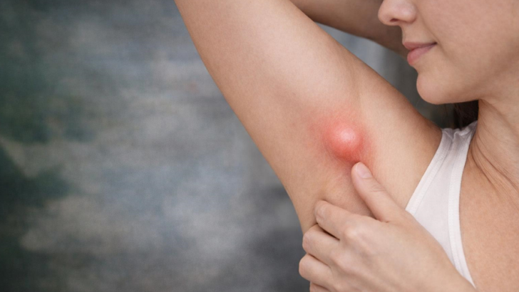 KOLTUK ALTINDAKİ ŞİŞLİK HER ZAMAN MASUM DEĞİL: EKTOPİK MEME DOKUSU UYARISI